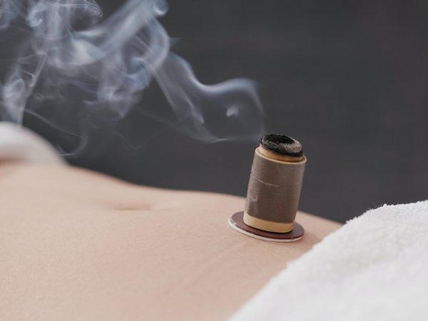 Chinese traditional medicine moxibustion therapy